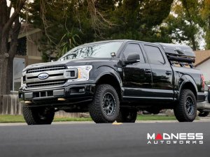 Ford F-150 Enhanced Tow Hook - Aluminum - Black Ford F-150 Enhanced Tow Hook - Aluminum - Black